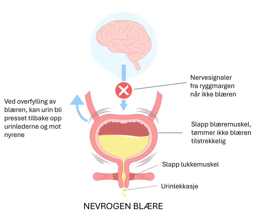 Diagram, schematic